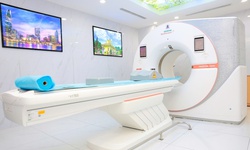 Ứng dụng hệ thống CT đếm Photon trong bệnh lý tim mạch người trẻ
