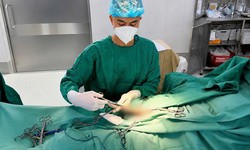 Cụ ông 74 tuổi mệt mỏi khi có 'rổ sỏi' lạo xạo trong bao quy đầu