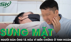 Tá hỏa vì tinh hoàn gặp biến chứng do chủ quan với dấu hiệu sưng mặt