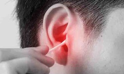 Côn trùng chui vào tai, xử trí sai có thể gây tổn thương thính lực