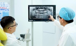 Bác sĩ CKI Trương Chí Bảo tư vấn: Bọc răng sứ loại nào tốt? Bảng giá và tiêu chí chọn răng sứ phù hợp