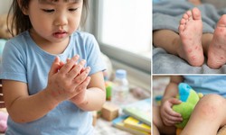 Tay chân miệng ở trẻ em: Những biến chứng cha mẹ không nên chủ quan