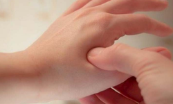 Huyệt Hợp Cốc hỗ trợ giảm đau và cách bấm đúng