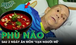 Người đàn ông phù não sau 2 ngày ăn món 'vạn người mê'