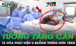 Tưởng tăng cân, nữ sinh 17 tuổi phát hiện khối u buồng trứng nặng hơn 10kg