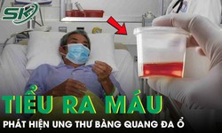 Phát hiện ung thư bàng quang đa ổ từ dấu hiệu tiểu ra máu