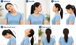 5 bài tập giúp cải thiện độ linh hoạt cột sống cổ