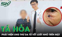 Tá hỏa phát hiện ung thư da từ vết loét nhỏ trên mặt