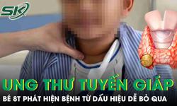 Bé trai 8 tuổi phát hiện mắc ung thư tuyến giáp từ dấu hiệu hàng triệu người bỏ qua