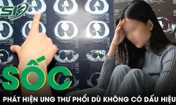 Đi khám tổng quát, người phụ nữ sốc khi phát hiện ung thư phổi dù không có dấu hiệu