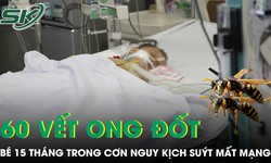 Bị ong vò vẽ đốt gần 60 nốt, bé trai 15 tháng suy đa tạng