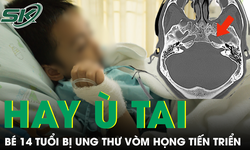 Bé trai 14 tuổi liên tục ù tai, bác sĩ phát hiện ung thư vòm mũi họng giai đoạn tiến triển