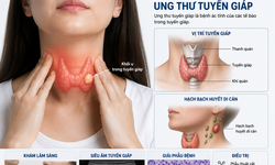 Sau mổ ung thư tuyến giáp, ai cần điều trị I-131?