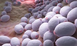 Đau rát vùng miệng, lưỡi kéo dài cảnh giác với nấm miệng họng do Candida