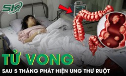 Cô gái 26 tuổi tử vong sau 5 tháng phát hiện ung thư ruột từ triệu chứng đau bụng