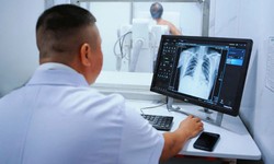 Những cơn ho tưởng vô hại nhưng lại là dấu hiệu của một căn bệnh hiểm nghèo