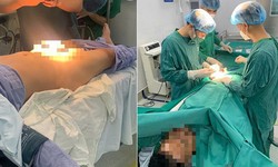 Gãy dương vật sau cú va mạnh, người đàn ông phải cấp cứu