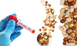 Tăng acid uric máu không chỉ do hải sản mà còn do nhiều thói quen 