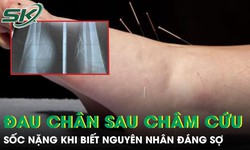 Đau chân dữ dội sau châm cứu, người phụ nữ sốc nặng khi biết nguyên nhân
