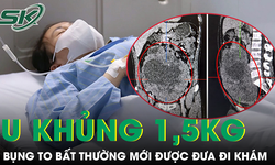 Người phụ nữ 42 tuổi mang khối u 1,5 kg trong ổ bụng mà không hay biết