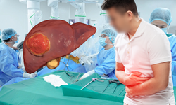 Ngỡ rối loạn tiêu hóa, người đàn ông bất ngờ phát hiện ung thư gan