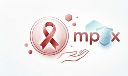 Người nhiễm HIV cần lưu ý gì khi mắc mpox?