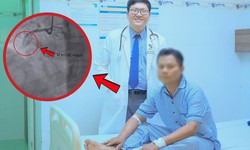 Đang khỏe mạnh, người đàn ông bất ngờ lên cơn nhồi máu cơ tim suýt chết