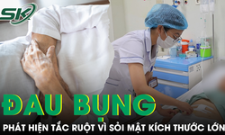 Tự điều trị đau bụng dài ngày, cụ bà tắc ruột vì sỏi mật kích thước lớn