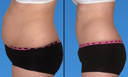 Giảm cân hợp lý cách nào?