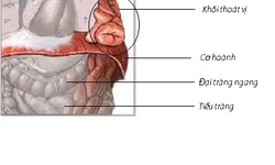 Tho&#225;t vị ho&#224;nh bẩm sinh - Tỉ lệ sống thấp, v&#236; sao?