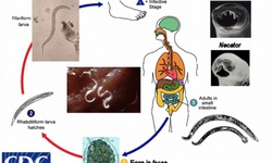 Giun m&#243;c v&#224; giun mỏ - Kẻ h&#250;t m&#225;u đ&#225;ng gh&#233;t