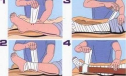 Xử tr&#237; khi bị rắn độc cắn