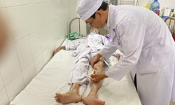 Cụ b&#224; 104 tuổi tắc mạch cấp được phẫu thuật cứu sống th&#224;nh c&#244;ng