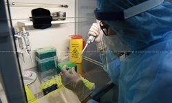 Bệnh viện Ung bướu Nghệ An thực hiện x&#233;t nghiệm t&#236;m virus SARS-CoV-2