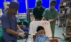 Thanh xà beng dài 1m đâm xuyên ngực người đàn ông
