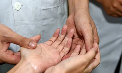 Bệnh tăng tiết mồ hôi tay