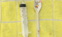 Cô gái 18 tuổi không may nuốt...trôi thìa nhựa