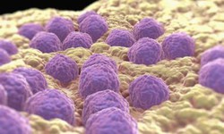 Tại sao bị cho&#225;ng khi ti&#234;m ph&#242;ng sởi - Rubella?