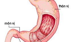 Vi&#234;m hang vị sung huy&#234;́t c&#243; nguy hiểm?