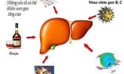 7 biện ph&#225;p tự nhi&#234;n để giảm men gan