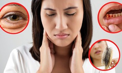 C&#225;ch nhận biết cơ thể thiếu vitamin