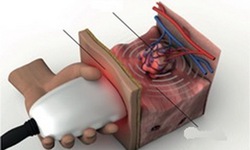 Tr&#237; tuệ nh&#226;n tạo gi&#250;p cải thiện chất lượng h&#236;nh ảnh y, sinh học