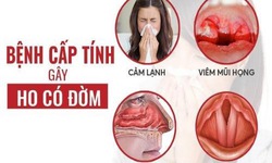 D&#249;ng thuốc trị ho c&#243; đờm