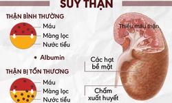 Ph&#225;t hiện sớm v&#224; dự ph&#242;ng bệnh thận mạn t&#237;nh