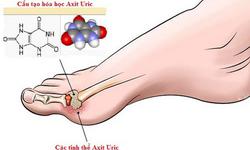 Xử trí tăng acid uric máu