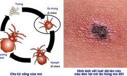 Nguy cơ tử vong do sốt mò