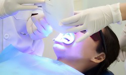 Tẩy trắng răng bằng laser thế n&#224;o?