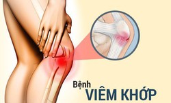 Thuốc ức chế TNF trị viêm khớp làm tăng nhu cầu dùng thuốc giảm đau opiod