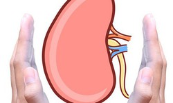 Những điều cần làm để bảo vệ chức năng thận