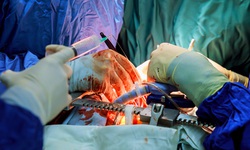 Mẫu thuẫn ở phòng trọ, thanh niên bị bạn đâm thấu gan, thủng cơ hoành